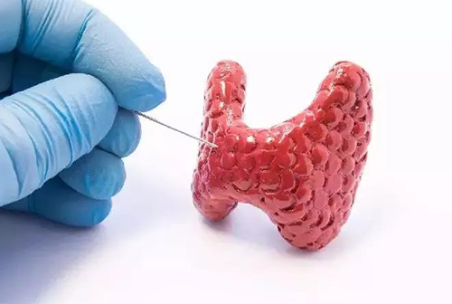 甲状腺疾病，包括甲状腺功能减退和甲状腺功能亢进，自古以来就是反复被医学研究人员研究的疾病