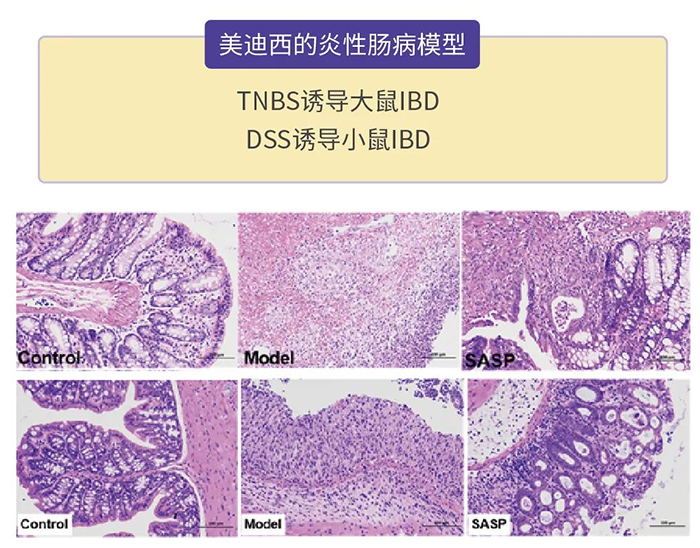 人生就是博的炎性肠病模型.png 人生就是博的炎性肠病模型.png